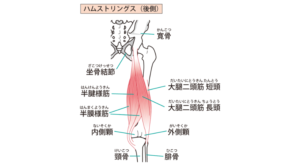 後面から見た骨盤と太ももの骨格イラストで、太もも裏の筋肉群である大腿二頭筋、半腱様筋、半膜様筋が赤く描かれた画像で、【ハムストリングス(大腿後面周辺)】の柔軟性低下や過緊張が引き起こす、前屈みになった時の太もも裏のピキッとする突っ張り感や、骨盤が下方に引っ張られることによる後傾・フラットバック由来の慢性的な腰痛のメカニズムを解説している様子。体の使い方説明やエクササイズ時に使われる(使いたい)筋肉としての説明、筋肉の機能的な解説時に積極的に使用してください。